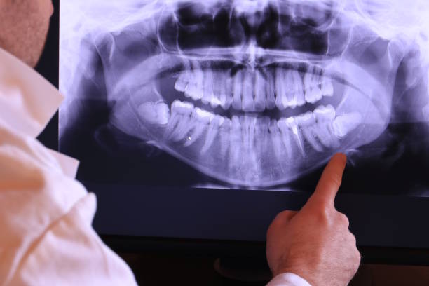 Best Emergency Tooth Extraction in Armonk, NY