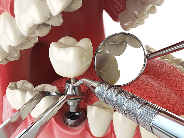 Best Emergency Denture Repair in Armonk, NY